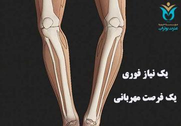 یک نیاز فوری، یک فرصت مهربانی/ تامین شد